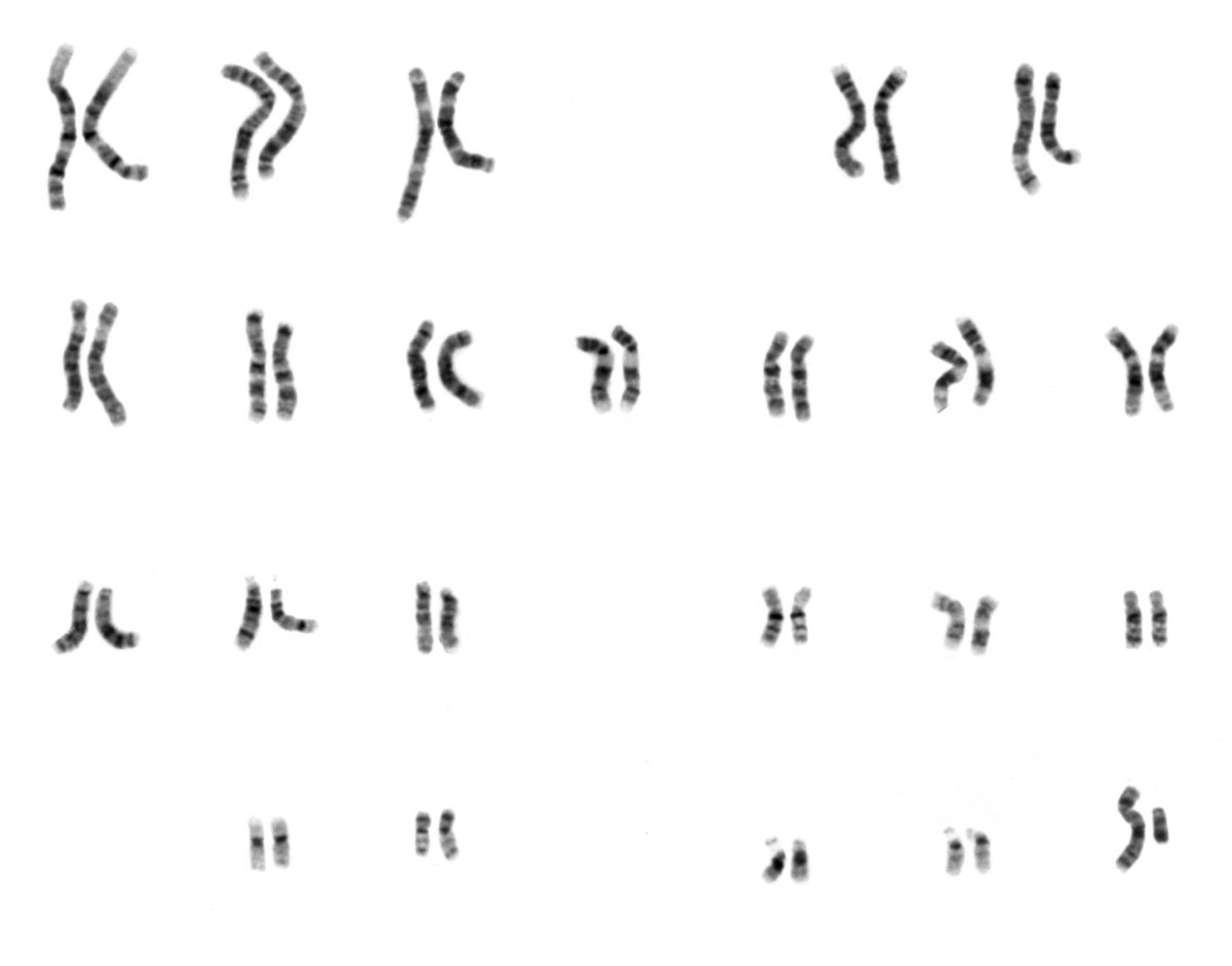 A photographic arrangement of human chromosomes sorted into twenty-three numbered pairs, each pair matched by size and banding pattern.