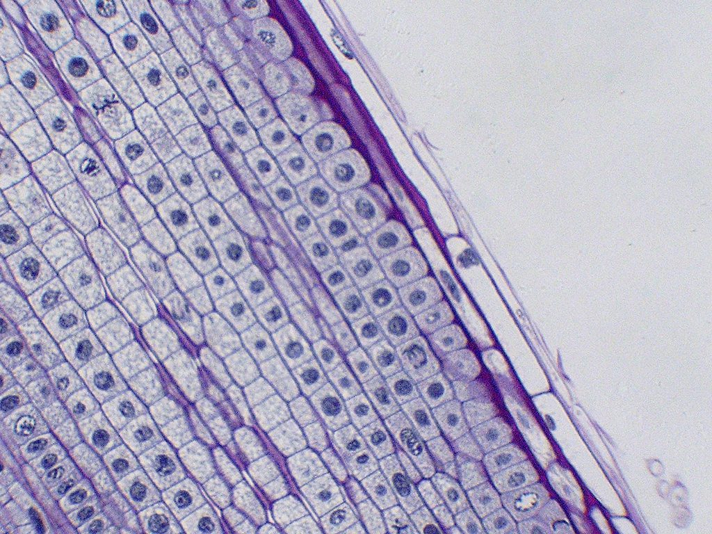 A light micrograph of an onion root tip in which different cells are frozen at different stages of division, some with visible condensed chromosomes.